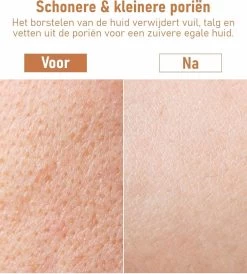 Fesio Lichaamsborstel Met Lange Steel - Dubbelzijdig - Dry Brushing Rugborstel/Badborstel/Doucheborstel/Huidborstel - 43 Cm 14 Fesio Lichaamsborstel Met Lange Steel - Dubbelzijdig - Dry Brushing Rugborstel/Badborstel/Doucheborstel/Huidborstel - 43 Cm -Lichaamsverzorging 1080x1200 1