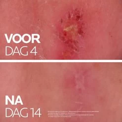 La Roche-Posay Cicaplast Balsem B5+ - 40ml - Voor Gevoelige Huid - Helpt De Huid Herstellen 19 La Roche-Posay Cicaplast Balsem B5+ - 40ml - Voor Gevoelige Huid - Helpt De Huid Herstellen -Lichaamsverzorging 1200x1200 2