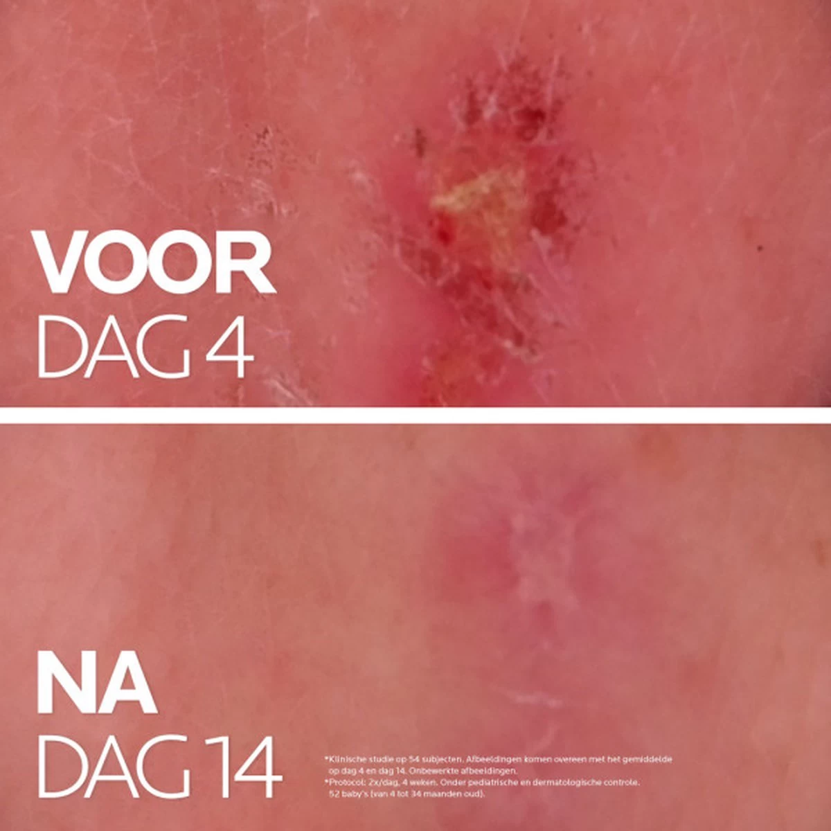 La Roche-Posay Cicaplast Balsem B5+ - 40ml - Voor Gevoelige Huid - Helpt De Huid Herstellen 10 La Roche-Posay Cicaplast Balsem B5+ - 40ml - Voor Gevoelige Huid - Helpt De Huid Herstellen - Afbeelding 10