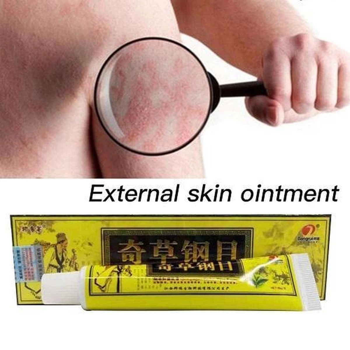 Psoriasis/exzeem Chineese Creme 5 Psoriasis/exzeem Chineese Creme - Afbeelding 5